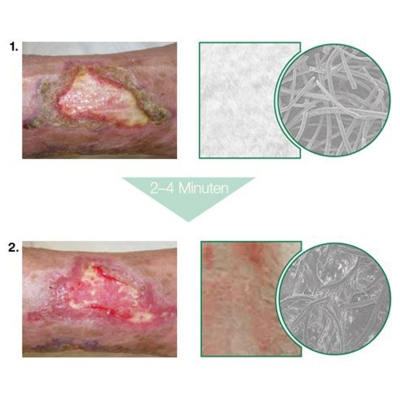 Debrisoft Pad (Debrisoft Pad)