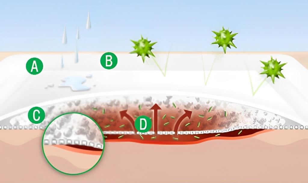 Vliwasorb adhesive (Highly absorbent adhesive dressing)