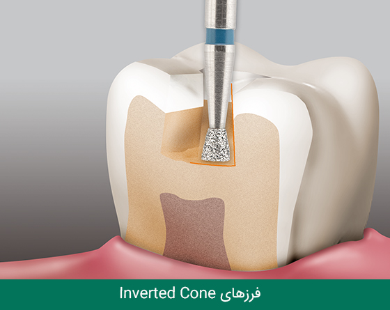 01 فرز دندانپزشکی مایزینگر
