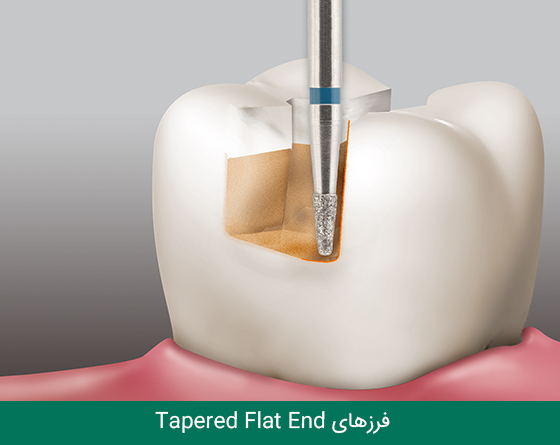 02 فرز دندانپزشکی مایزینگر