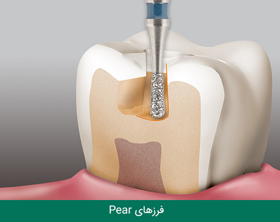 03 فرز دندانپزشکی مایزینگر